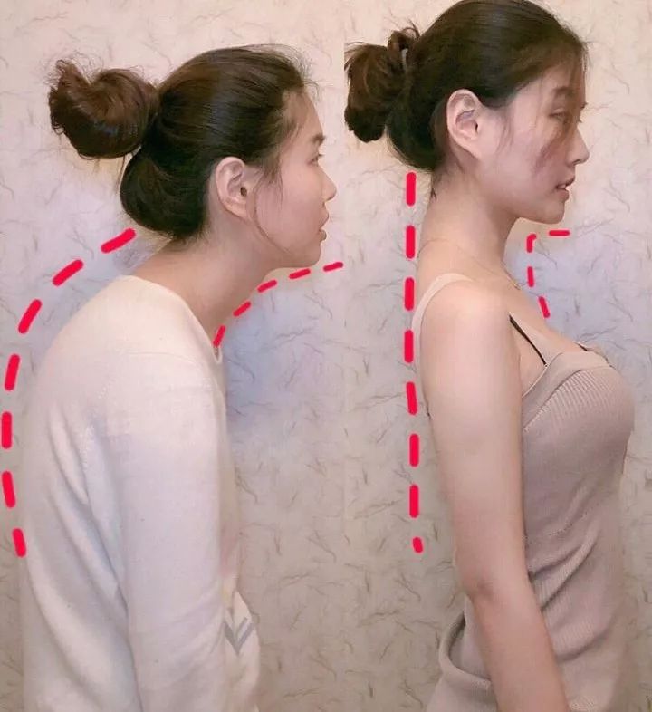 21天矫正含胸驼背,让你挺胸抬头自信满满,从此走向人生巅峰