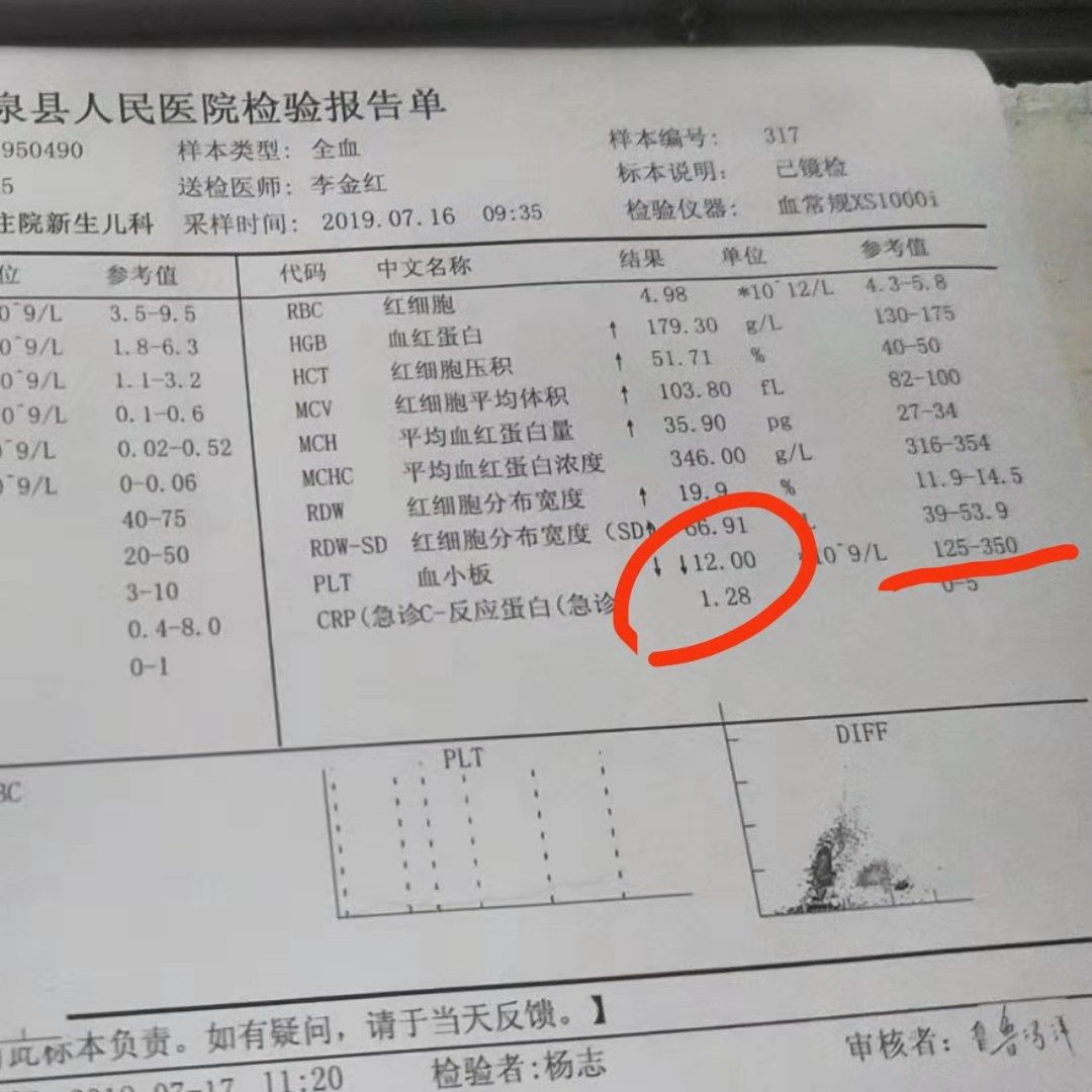需要血型o型,抽取血