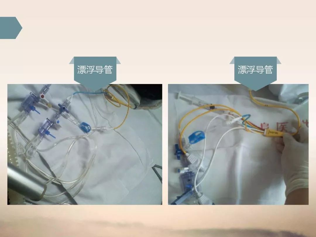 ppt资源危重患者使用留置管路的护理