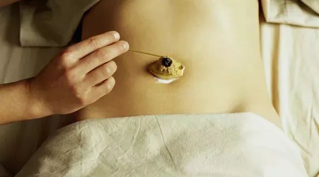 隔盐灸:用纯净的食盐填敷于脐部,上置艾炷施灸,对缓解脾虚泻泄,失眠