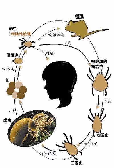5cm×1cm焦痂,考虑为恙虫病感染所致,给予气管插管呼吸机