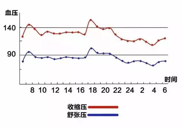 孕妇24小时动态血压图片