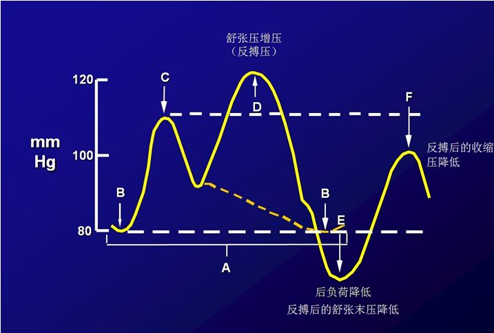 (2)压力监测:密切监测收缩压,舒张压,平均压,反搏压大小及波形,以评估