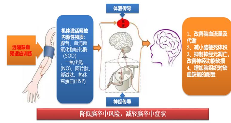 健康丹東缺血訓練不放鬆新招防治腦卒中暨卒中俱樂部公益宣教義診大會