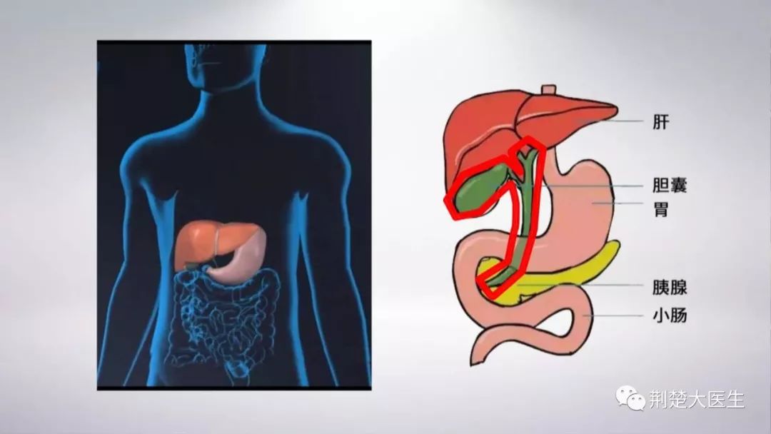 胆囊痛的位置示意图图片