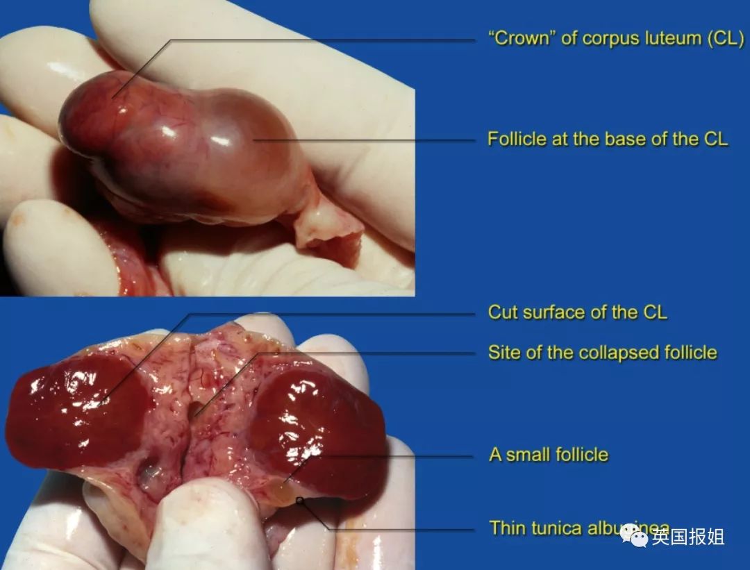 女孩子注意因玩水上滑梯她子宫撕裂差点命都没了