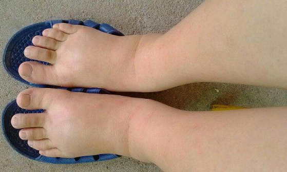 男人一天排尿接近"这个数",尿毒症可能离你还很远,不妨自测