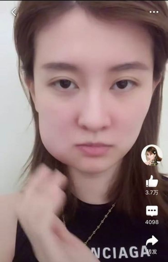 松鼠滤镜?乔欣拔牙脸超肿 网友怀疑开特效