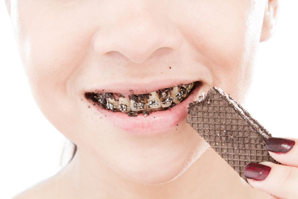 扎心了,带牙套后宁愿爽约男友都不敢爽约医生