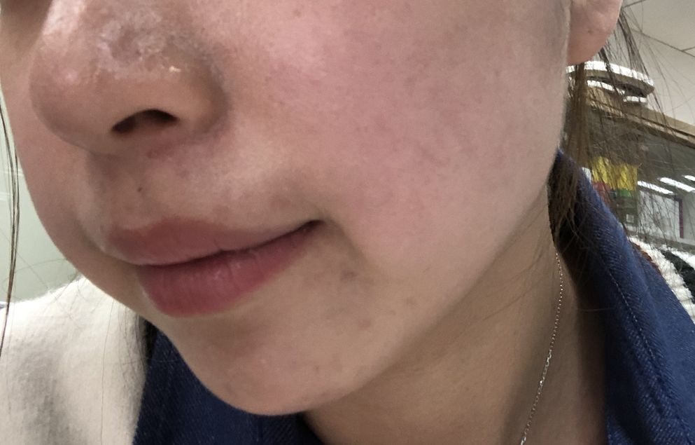 吃了这粒"7日回春"丸,皮肤亲测亮白又水润!