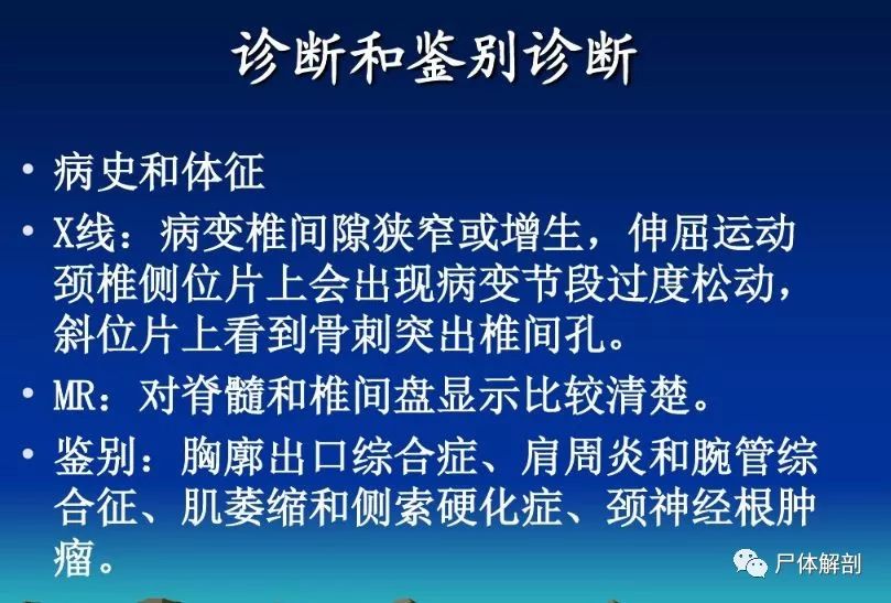 圖解頸椎精細解剖頸椎病