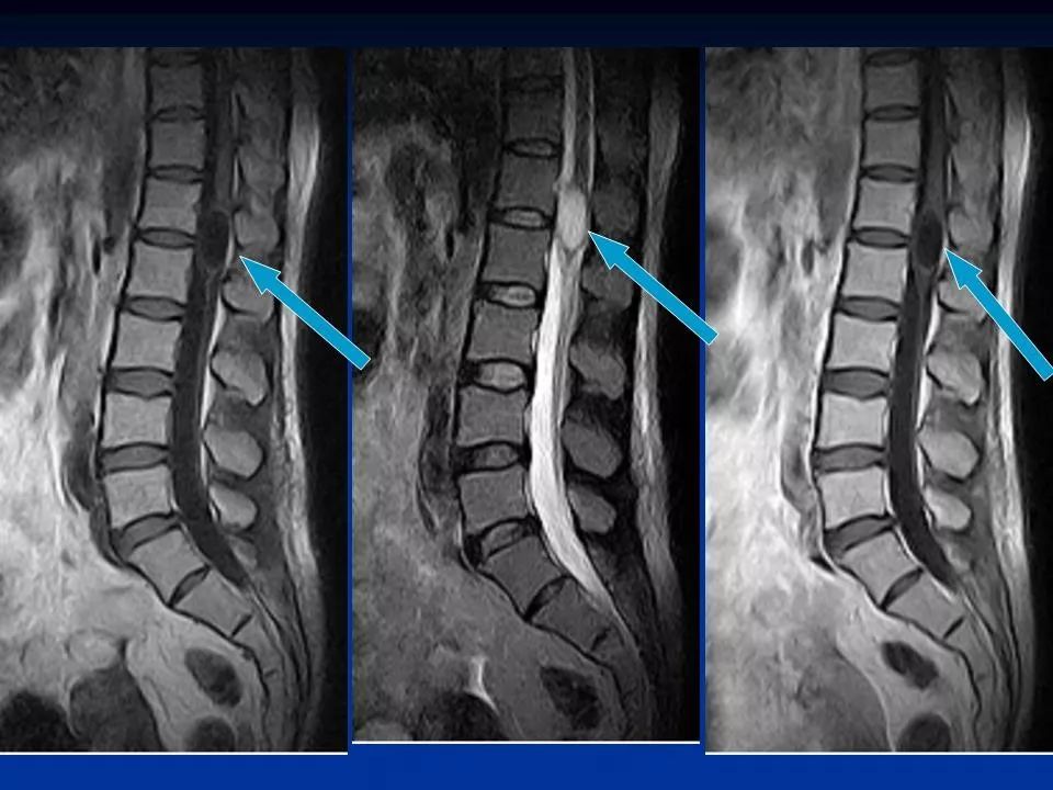 影像学在脊柱脊髓的应用第一部分影像天地