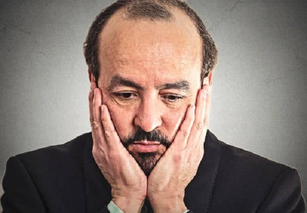 为什么男性脱发会变成地中海