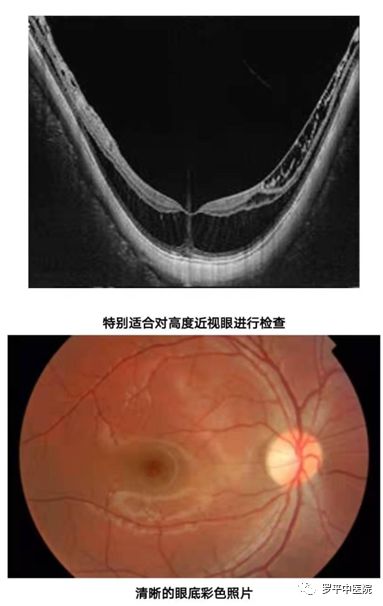 3,糖尿病,高血壓或高血脂患者;4,具有青光眼及其他眼底病家族史的人群