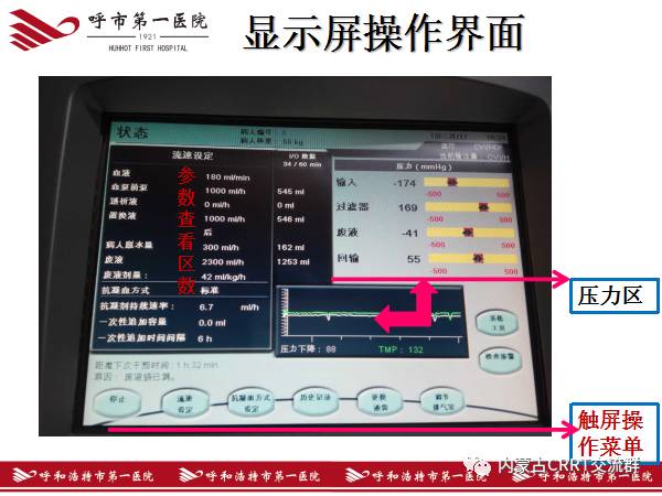 图解(金宝)CRRT治疗全过程,一步一步教会你!_内蒙古