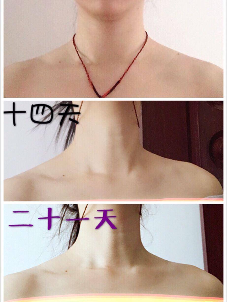 性感的味道,一块让你视觉上瘦5斤的骨头!_锁骨