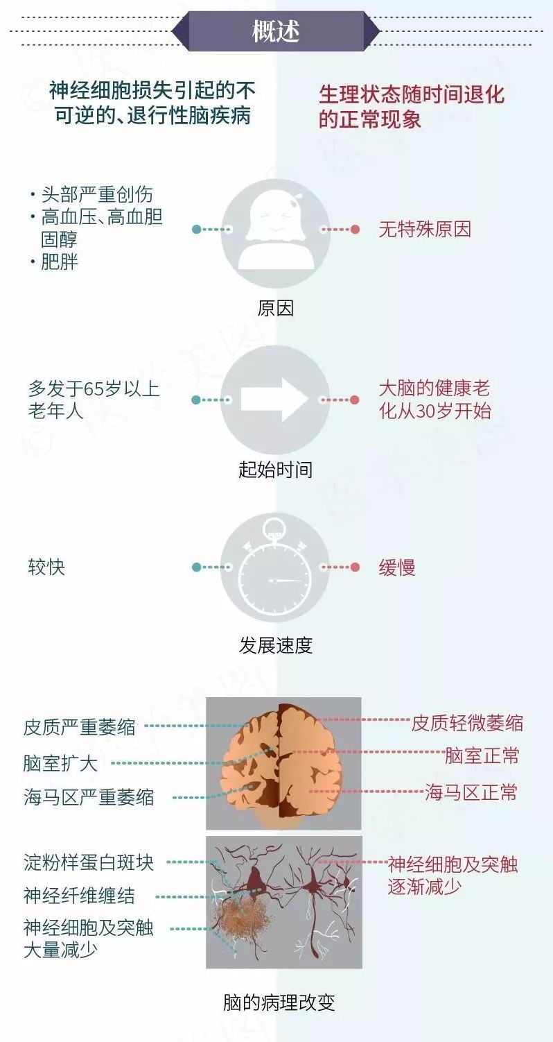 一图读懂阿尔茨海默病和正常衰老