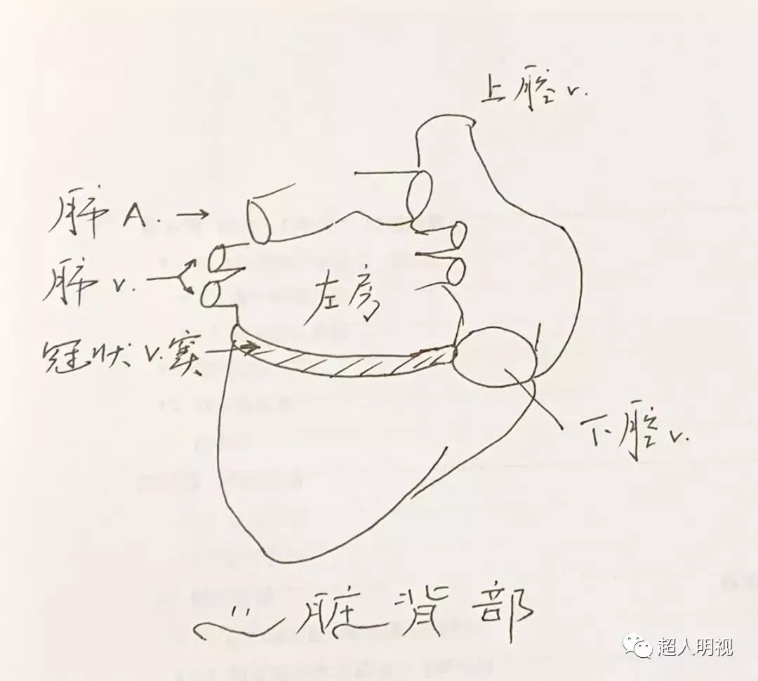 永存左上腔静脉示意图图片