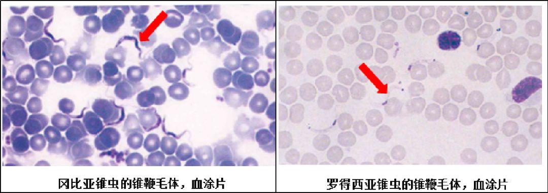 寻虫环游记第七站锥虫上非洲锥虫病