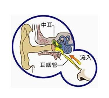 當心鼻炎變成中耳炎_治療