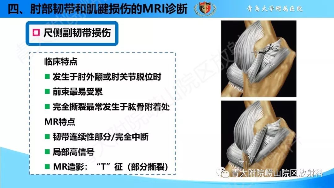 肘韧带,韧带,髌韧带(第9页)_大山谷图库