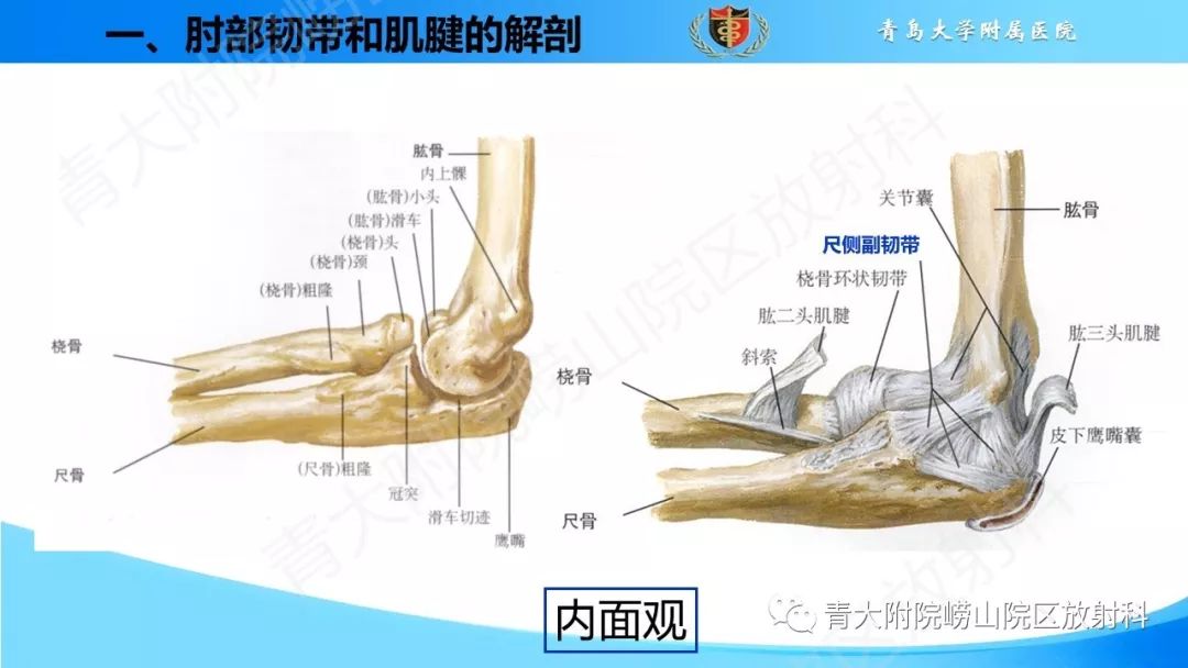 肘部韧带和肌腱损伤的mri诊断