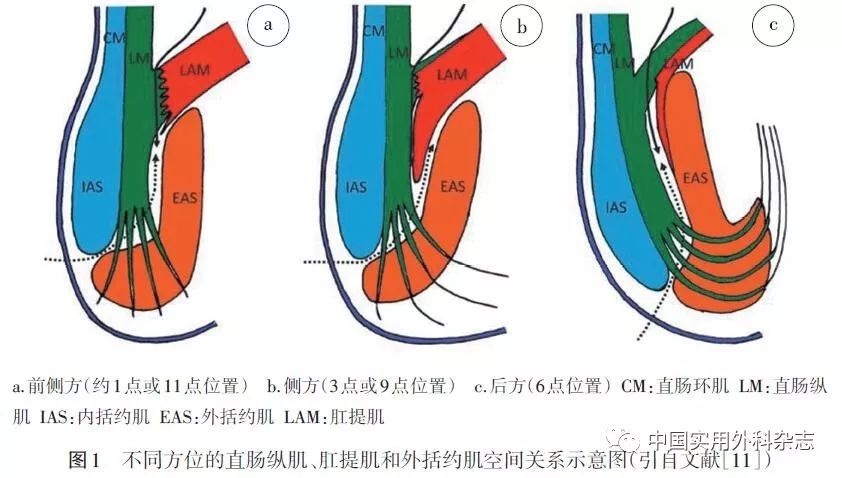 讲座|Hiatal韧带解剖研究的临床意义和应用_直肠
