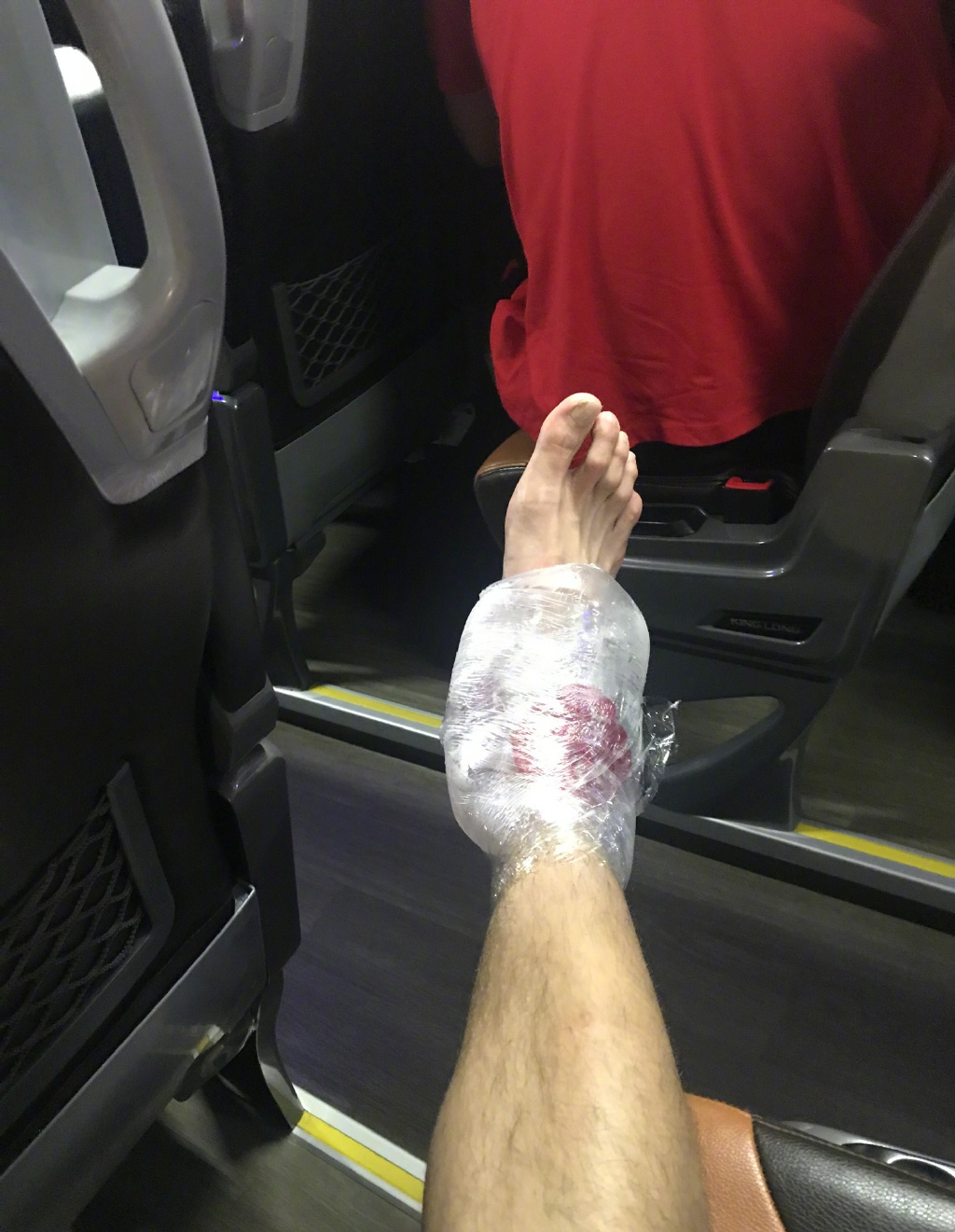 不利消息!中国男篮输球夜 主力球员扭脚无法上台领奖