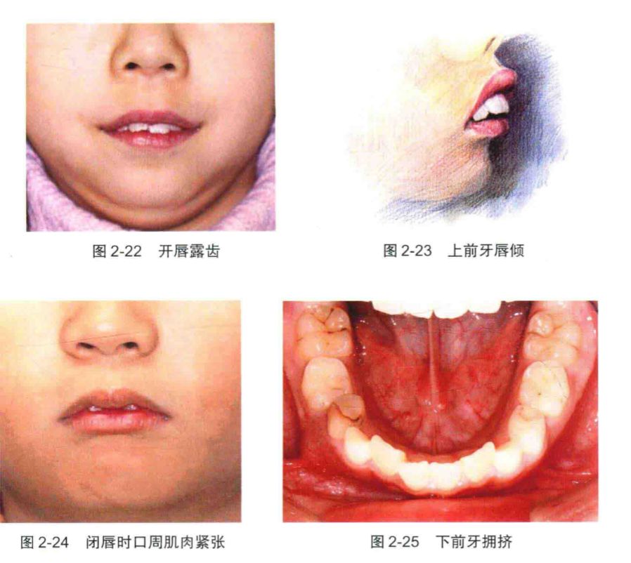 健康科普┃比你好看的人原来都没有这些习惯