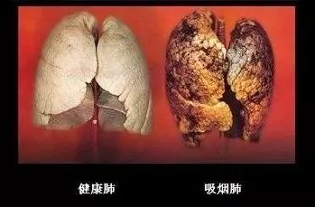 4亿二手烟受害者的黑肺有救啦!