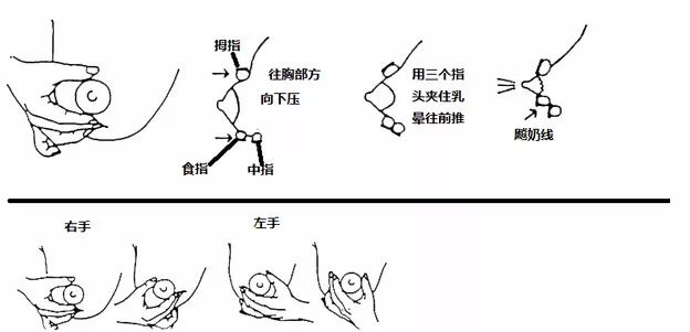 宝妈不容错过 3招搞定急性乳腺炎