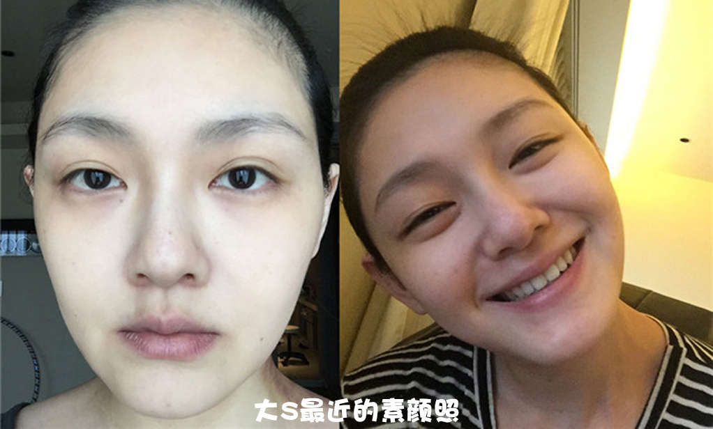 总所周知,大s不是天生的白皮美人,小时候的大s黑到被群嘲"天生黑肉底"