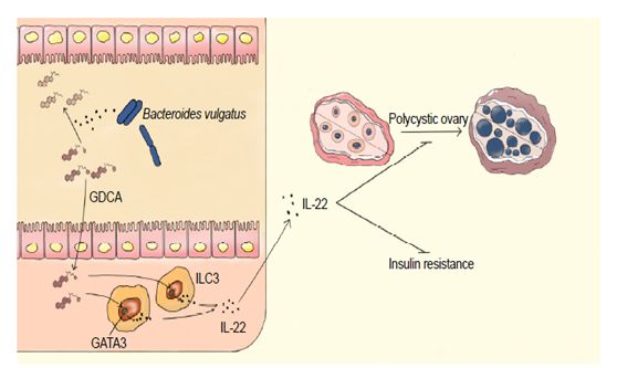 圖 腸道菌群-膽汁酸-il-22調控pcos新機制模式圖該研究以腸道菌代謝