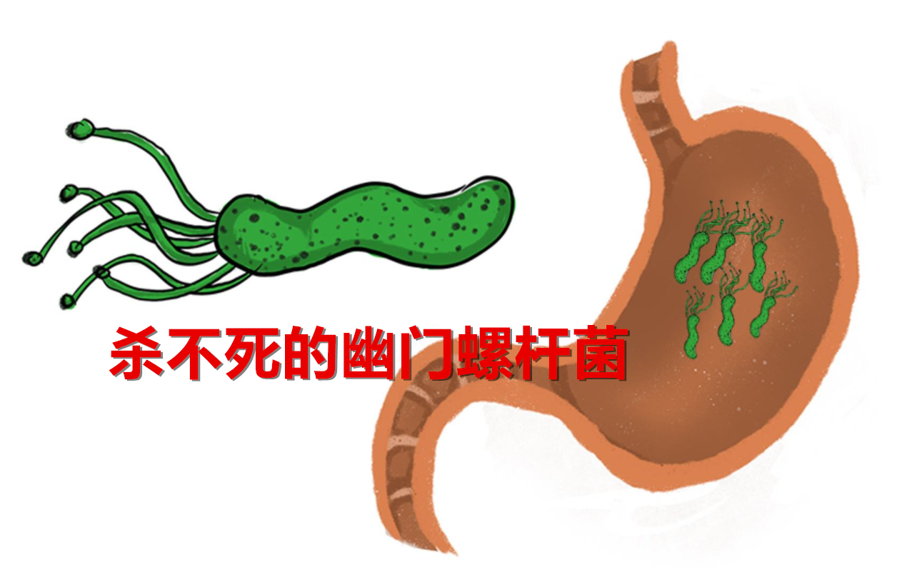 幽门螺杆菌阳性就会得胃癌吗医生先确认是否有这9个症状