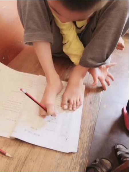 新生儿黄疸致脑瘫,广东10岁男孩学会用脚写字画画