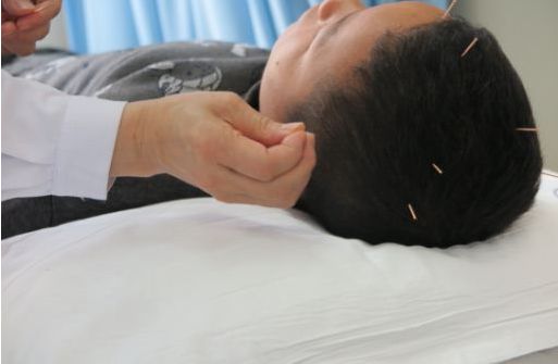 针灸科研究课题《方氏头针联合穴位注射治疗气滞血瘀型突发性耳聋临床