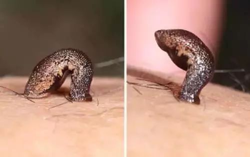 山蛭水蛭温馨提示并非所有鼻出血都有蚂蟥寄生鼻腔所致,大部分患儿鼻