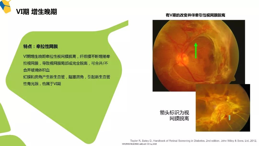 多年来倡导的多学科合作,现在糖网病有了明确章程!
