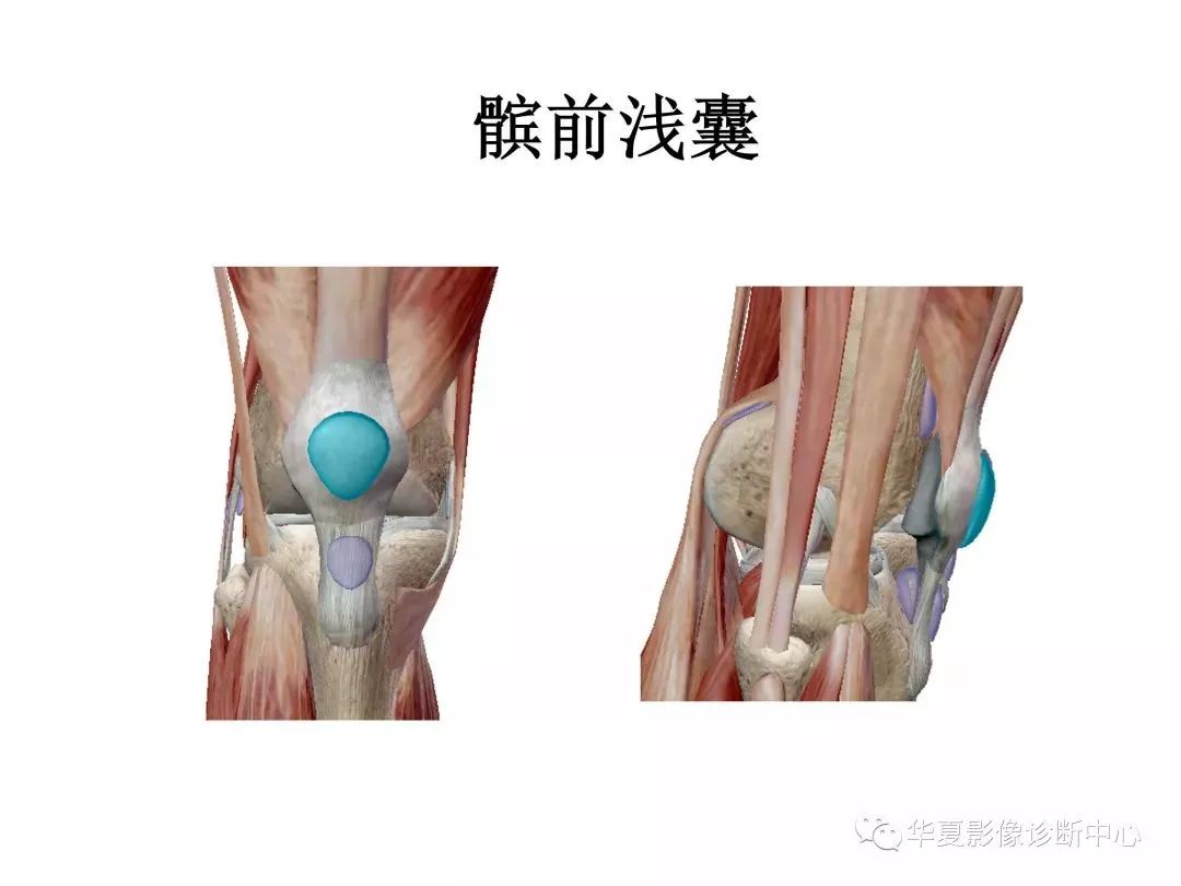 膝關節3d全綵解剖圖譜解剖學老師推薦的