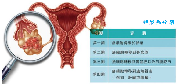 得了卵巢癌怎么办手术能治好吗江苏省肿瘤医院赵一兵