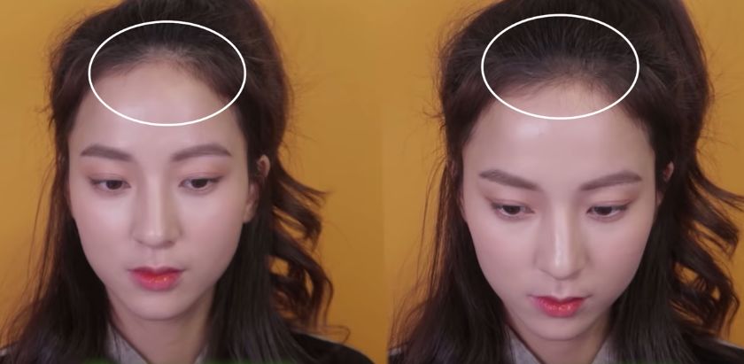 回国后的程潇竟然已经秃到只剩下半个脑袋了