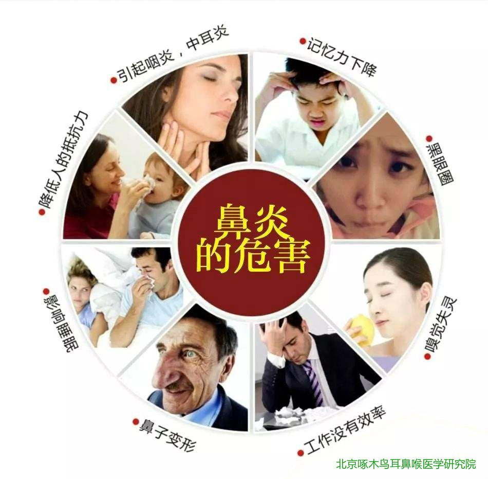 鼻炎,鼻窦炎,过敏性鼻炎三者有哪些区别_症状