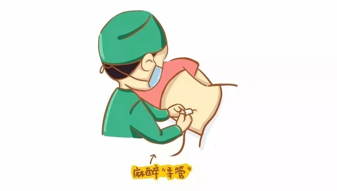 解密关于无痛分娩的9大疑问答案都在这