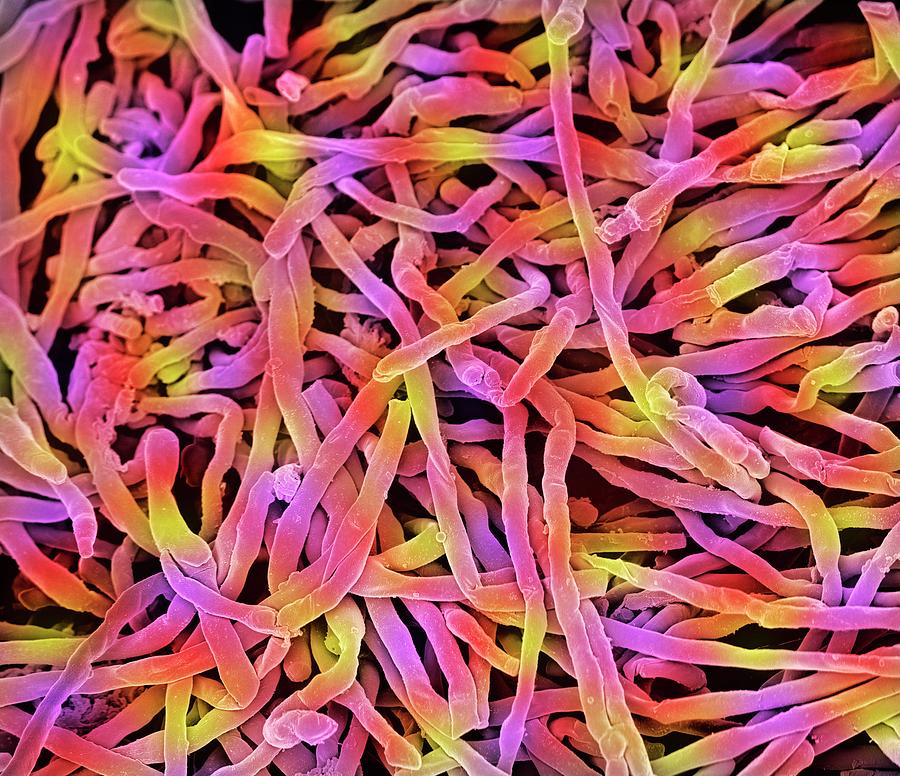 对温度的不同要求,嗜热菌可划分为3类:1,兼性嗜热