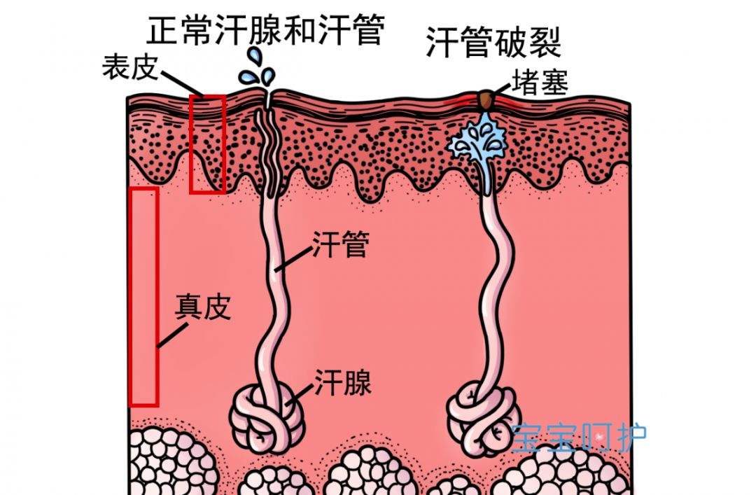 高溫來襲滾滾熱浪在外奔波如何理解身體發出的十個信號