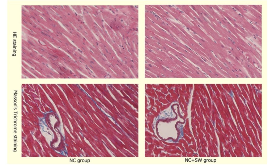 心肌苏木精伊红(he)及masson染色nc_sw组超微结构变化nc组和nc组的