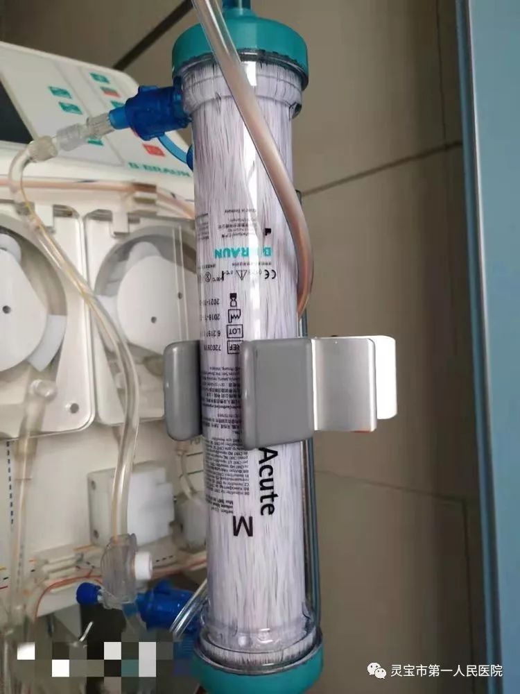 (图为经24小时治疗后的血滤器及血路管路,较普通方案的抗凝剂相比