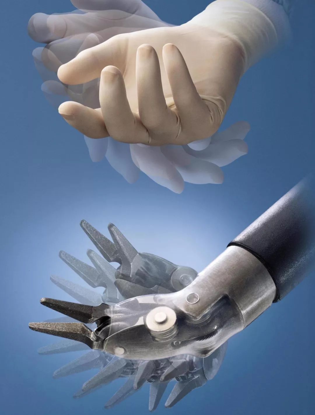 新技术新里程丨泌尿外科谌诚教授达芬奇机器人手术百例突破开启微创