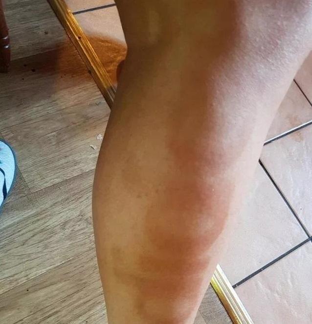 英女子太阳下穿阿迪打底裤被印上商标想成代言人阿迪无情拒绝