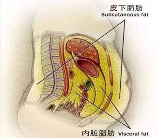 啤酒肚脂肪解剖图图片